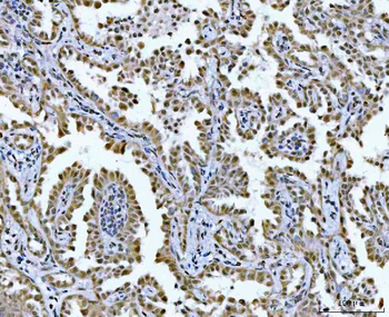 GLIS1 Rabbit Polyclonal Antibody