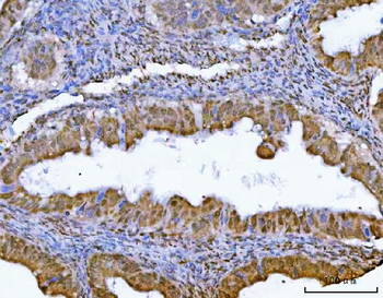 GLIS1 Rabbit Polyclonal Antibody