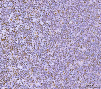 GLIS1 Rabbit Polyclonal Antibody