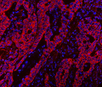 CLASP1 Rabbit Polyclonal Antibody