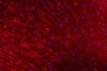 CLASP1 Rabbit Polyclonal Antibody