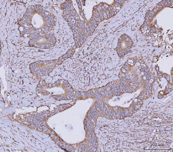 CLASP1 Rabbit Polyclonal Antibody