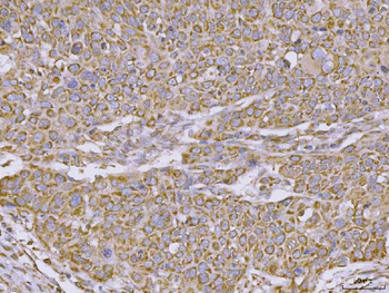 CLASP1 Rabbit Polyclonal Antibody