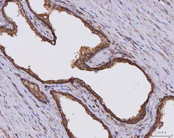 CLASP1 Rabbit Polyclonal Antibody