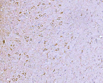 CLASP1 Rabbit Polyclonal Antibody