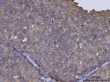ARL1 Rabbit Polyclonal Antibody