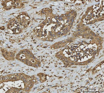 Annexin A10/ANXA10 Rabbit Polyclonal Antibody