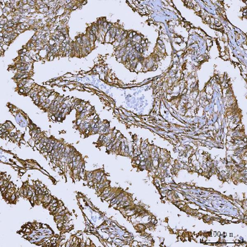 Annexin A10/ANXA10 Rabbit Polyclonal Antibody