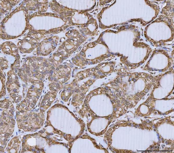 Annexin A10/ANXA10 Rabbit Polyclonal Antibody