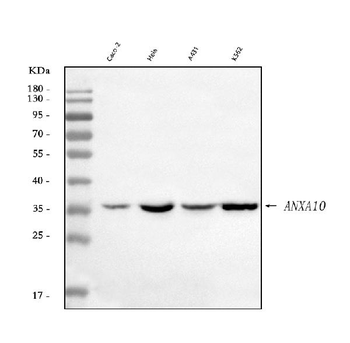 Annexin A10/ANXA10 Rabbit Polyclonal Antibody