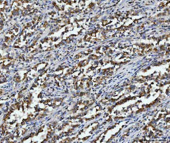 Aconitase 2 Mouse Monoclonal Antibody