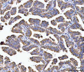 Aconitase 2 Mouse Monoclonal Antibody