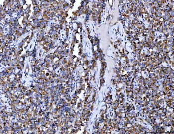 Aconitase 2 Mouse Monoclonal Antibody