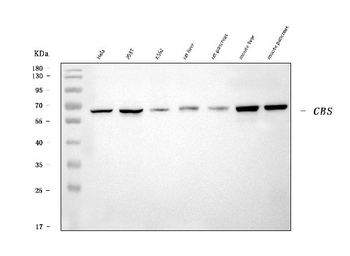 CBS Mouse Monoclonal Antibody