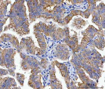 gamma Catenin Mouse Monoclonal Antibody