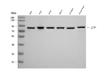 gamma Catenin Mouse Monoclonal Antibody