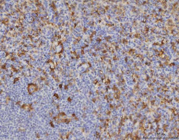 ME1 Mouse Monoclonal Antibody