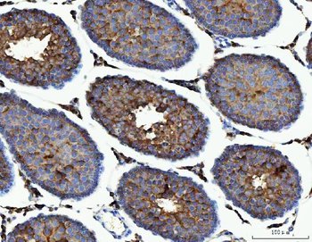 ME1 Mouse Monoclonal Antibody