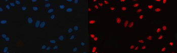 CPSF6 Mouse Monoclonal Antibody