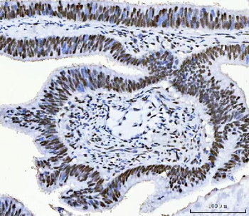 CPSF6 Mouse Monoclonal Antibody