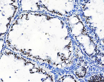 CPSF6 Mouse Monoclonal Antibody