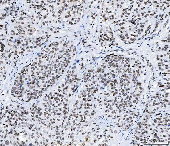 CPSF6 Mouse Monoclonal Antibody