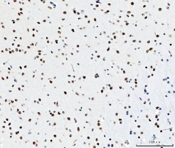 CPSF6 Mouse Monoclonal Antibody
