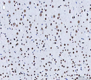 CPSF6 Mouse Monoclonal Antibody