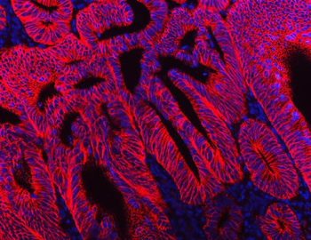 NKCC1/SLC12A2 Mouse Monoclonal Antibody