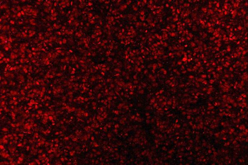 AREB6/ZEB1 Antibody (monoclonal, 8B12D7)