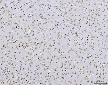 AREB6/ZEB1 Antibody (monoclonal, 8B12D7)