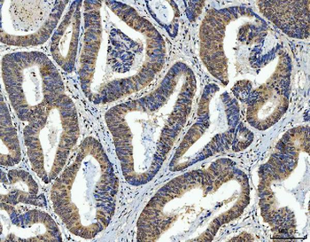 AREB6/ZEB1 Antibody (monoclonal, 8B12D7)