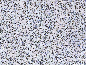 AREB6/ZEB1 Antibody (monoclonal, 8B12D7)