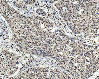 AREB6/ZEB1 Antibody (monoclonal, 8B12D7)