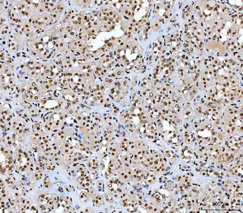 AREB6/ZEB1 Antibody (monoclonal, 8B12D7)