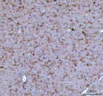 CCXCR1/XCR1 Rabbit Polyclonal Antibody