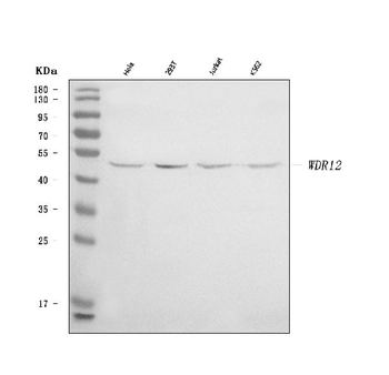 WDR12 Rabbit Polyclonal Antibody