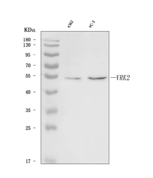 VRK2 Rabbit Polyclonal Antibody