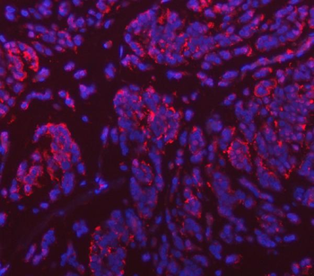 VPS53 Rabbit Polyclonal Antibody