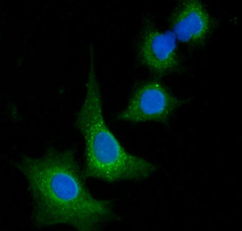 VPS53 Rabbit Polyclonal Antibody
