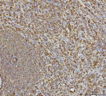 VPS53 Rabbit Polyclonal Antibody