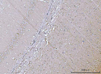 VPS53 Rabbit Polyclonal Antibody