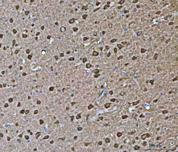 VPS53 Rabbit Polyclonal Antibody