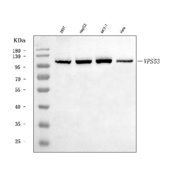 VPS53 Rabbit Polyclonal Antibody