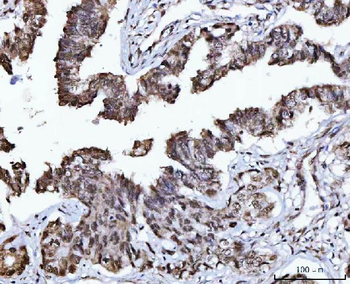 USP26 Rabbit Polyclonal Antibody