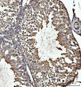 USP26 Rabbit Polyclonal Antibody