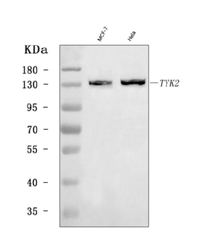 TYK2 Rabbit Polyclonal Antibody