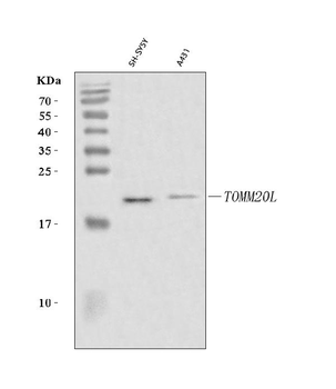 TOMM20L Rabbit Polyclonal Antibody