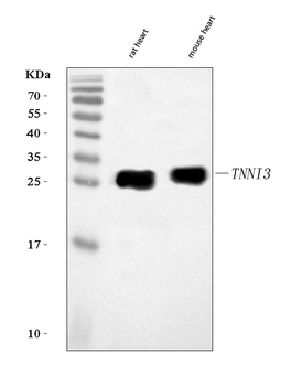 Cardiac Troponin I/TNNI3 Rabbit Polyclonal Antibody