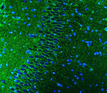 EAAT1/SLC1A3 Rabbit Polyclonal Antibody